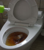 Những vấn đề thường gặp trong nhà vệ sinh và bồn cầu inax giá bao nhiêu